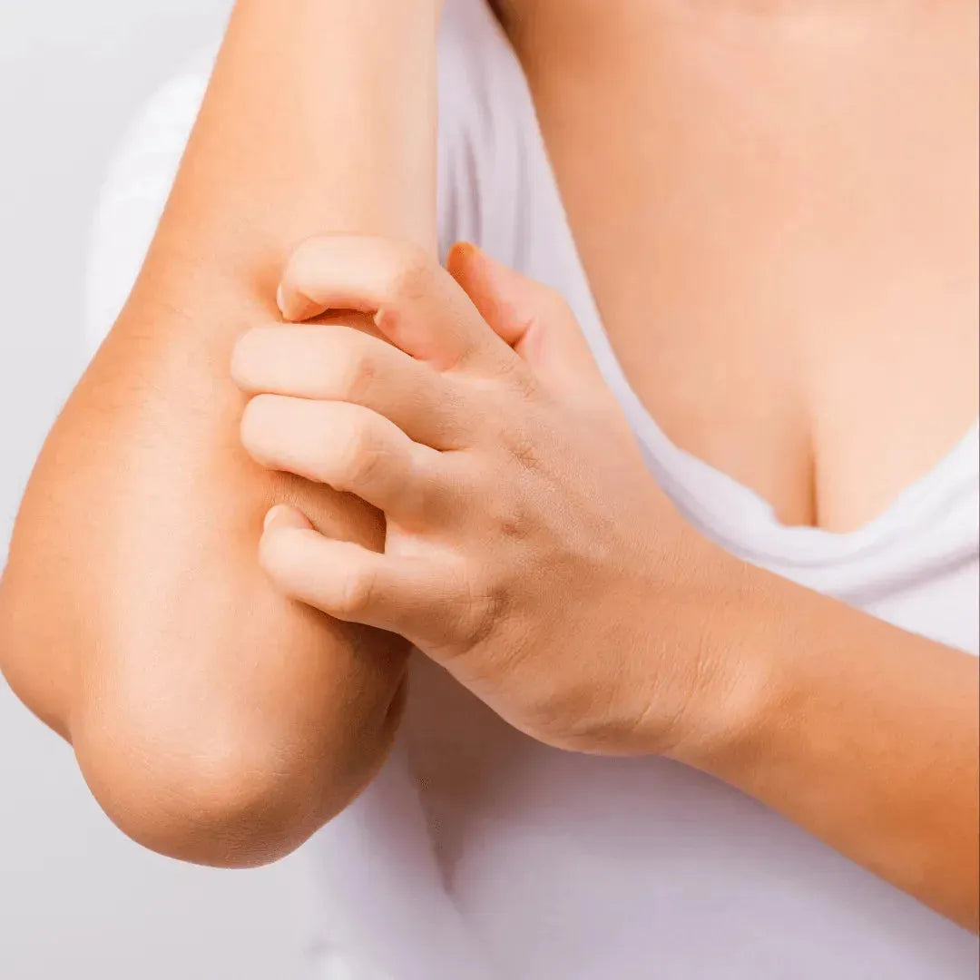 Fenistil Gel - anti-histamine gel, anti-allergic, anti-itch 100 g NOVARTIS CONSUMER HEALTH