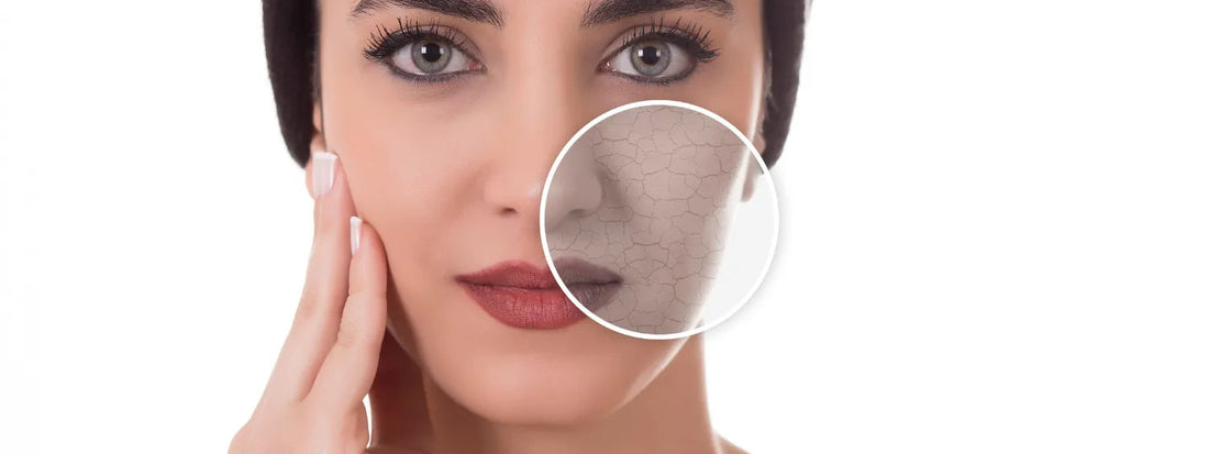 Close-up of woman's face with dry skin magnified, promoting skincare products from WEDOART-IL