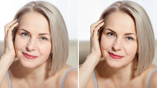 Before and after comparison of mature woman showing anti-aging skincare results, WEDOART-IL