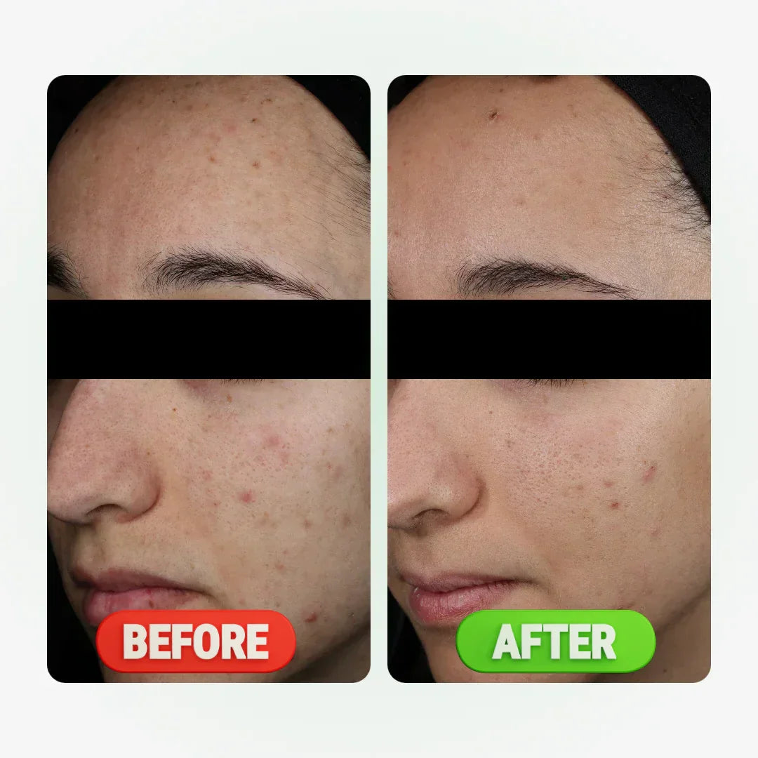 KAMEDIS - CLEAR Pore Minimizer Toner 200 ml Kamedis