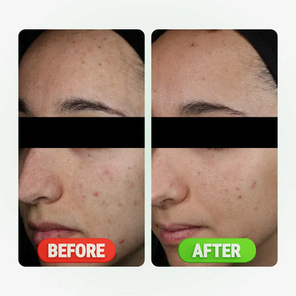 KAMEDIS - CLEAR Pore Minimizer Toner 200 ml Kamedis