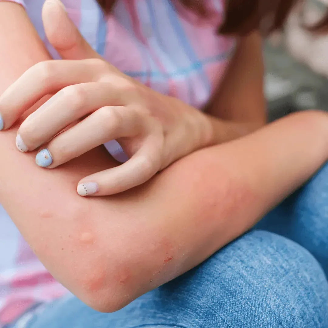 Child resting one hand on a forearm while sitting outdoors