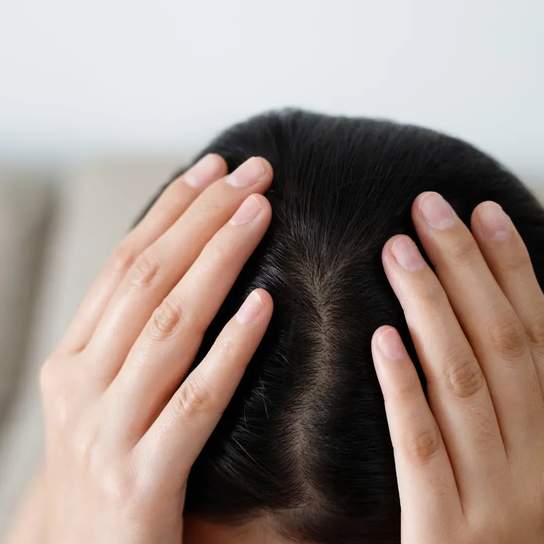 Hands resting on the top of a woman's head, showing her hair parting